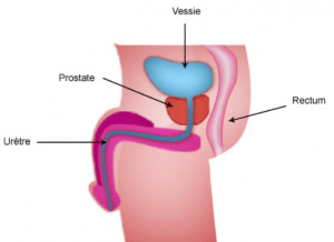 Maladies de la prostate - Urologue Dr. Sami Bekkali